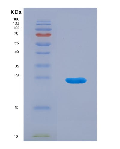 SDS-PAGE analysis of Mouse Tnfsf14 (Tumor Necrosis Factor Ligand Superfamily Member 14) - Recombinant Protein, CAT# BLT-07852P, showing >90% purity under 15% SDS-PAGE (Reduced)Mouse Tnfsf14 (Tumor Necrosis Factor Ligand Superfamily Member 14) - Recombinant Protein