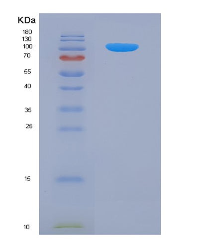 SDS-PAGE analysis of Human PDGFRA (Platelet-Derived Growth Factor Receptor Alpha) - Recombinant Protein, CAT# BLT-06206P, showing >90% purity under 15% SDS-PAGE (Reduced)Human PDGFRA (Platelet-Derived Growth Factor Receptor Alpha) - Recombinant Protein