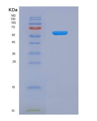 SDS-PAGE analysis of Human ADAM8 (Disintegrin And Metalloproteinase Domain-Containing Protein 8) - Recombinant Protein, CATHuman ADAM8 (Disintegrin And Metalloproteinase Domain-Containing Protein 8) - Recombinant Protein
