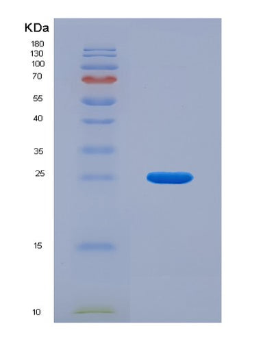 SDS-PAGE analysis of Human BMPR2 (Bone Morphogenetic Protein Receptor Type-2) - Recombinant Protein, CAT# BLT-05321P, showing >90% purity under 15% SDS-PAGE (Reduced)Human BMPR2 (Bone Morphogenetic Protein Receptor Type-2) - Recombinant Protein