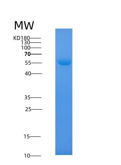 SDS-PAGE analysis of Human SHMT1 (Serine Hydroxymethyltransferase, Cytosolic) - Recombinant Protein, CAT# BLT-02778P, showing >85% purity under 15% SDS-PAGE (Reduced)Human SHMT1 (Serine Hydroxymethyltransferase, Cytosolic) - Recombinant Protein