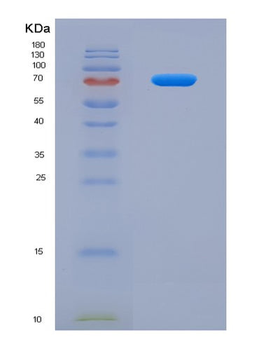 SDS-PAGE analysis of Human SLC3A2 (Amino Acid Transporter Heavy Chain Slc3A2) - Recombinant Protein, CAT# BLT-04163P, showing >95% purity under 15% SDS-PAGE (Reduced)Human SLC3A2 (Amino Acid Transporter Heavy Chain Slc3A2) - Recombinant Protein
