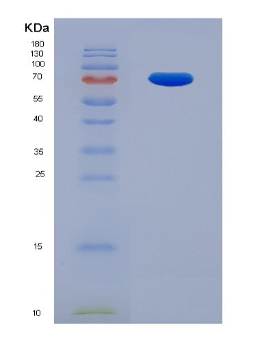 SDS-PAGE analysis of Human IFNAR1 (Interferon Alpha/Beta Receptor 1) - Recombinant Protein, CATHuman IFNAR1 (Interferon Alpha/Beta Receptor 1) - Recombinant Protein