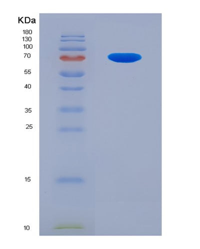 SDS-PAGE analysis of Human IL18R1 (Interleukin-18 Receptor 1) - Recombinant Protein, CAT# BLT-07855P, showing >90% purity under 15% SDS-PAGE (Reduced)Human IL18R1 (Interleukin-18 Receptor 1) - Recombinant Protein