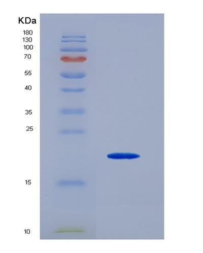 SDS-PAGE analysis of Human APP (Amyloid-Beta Precursor Protein) - Recombinant Protein, CAT# BLT-07763P, showing >90% purity under 15% SDS-PAGE (Reduced)Human APP (Amyloid-Beta Precursor Protein) - Recombinant Protein