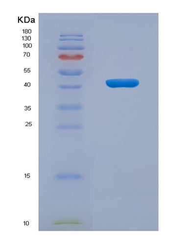 SDS-PAGE analysis of Human IL2RG (Cytokine Receptor Common Subunit Gamma) - Recombinant Protein, CAT# BLT-03747P, showing >95% purity under 15% SDS-PAGE (Reduced)Human IL2RG (Cytokine Receptor Common Subunit Gamma) - Recombinant Protein