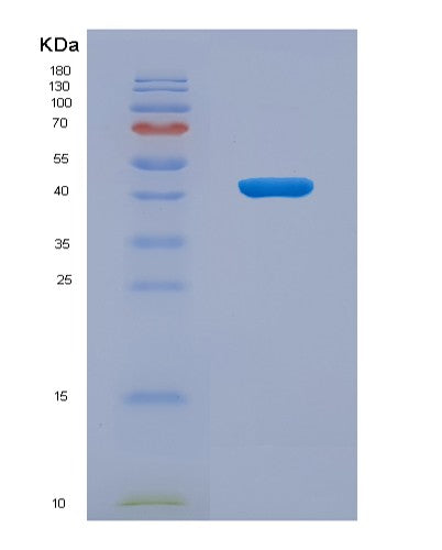 SDS-PAGE analysis of Human IL2RG (Cytokine Receptor Common Subunit Gamma) - Recombinant Protein, CATHuman IL2RG (Cytokine Receptor Common Subunit Gamma) - Recombinant Protein