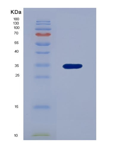 SDS-PAGE analysis of Human FOLR1 (Folate Receptor Alpha) - Recombinant Protein, CAT# BLT-03921P, showing >85% purity under 15% SDS-PAGE (Reduced)Human FOLR1 (Folate Receptor Alpha) - Recombinant Protein