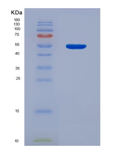 SDS-PAGE analysis of Human SIRPB1 (Signal-Regulatory Protein Beta-1) - Recombinant Protein, CAT# BLT-07856P, showing >90% purity under 15% SDS-PAGE (Reduced)Human SIRPB1 (Signal-Regulatory Protein Beta-1) - Recombinant Protein