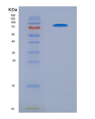 SDS-PAGE analysis of Human TYRO3 (Tyrosine-Protein Kinase Receptor Tyro3) - Recombinant Protein, CAT# BLT-07857P, showing >90% purity under 15% SDS-PAGE (Reduced)Human TYRO3 (Tyrosine-Protein Kinase Receptor Tyro3) - Recombinant Protein