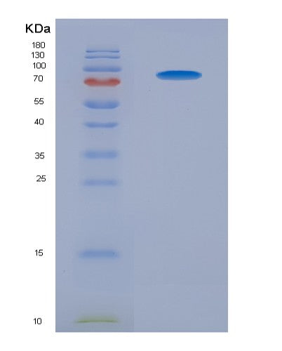 SDS-PAGE analysis of Human TYRO3 (Tyrosine-Protein Kinase Receptor Tyro3) - Recombinant Protein, CATHuman TYRO3 (Tyrosine-Protein Kinase Receptor Tyro3) - Recombinant Protein