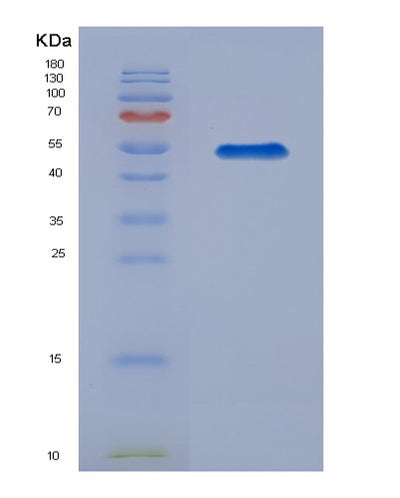 SDS-PAGE analysis of Human TPBG (Trophoblast Glycoprotein) - Recombinant Protein, CAT# BLT-07858P, showing >90% purity under 15% SDS-PAGE (Reduced)Human TPBG (Trophoblast Glycoprotein) - Recombinant Protein