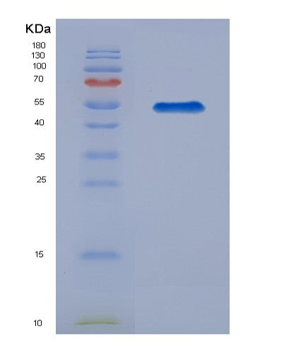 SDS-PAGE analysis of Human TPBG (Trophoblast Glycoprotein) - Recombinant Protein, CATHuman TPBG (Trophoblast Glycoprotein) - Recombinant Protein