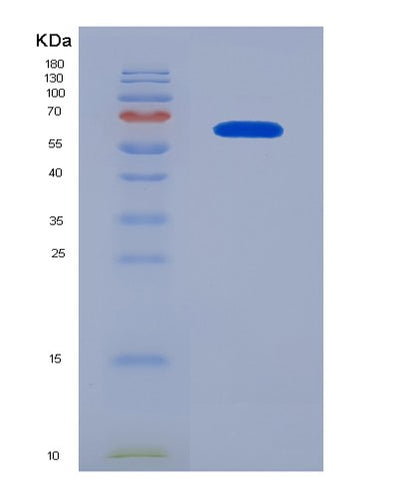 SDS-PAGE analysis of Human BSG (Basigin) - Recombinant Protein, CAT# BLT-03624P, showing >95% purity under 15% SDS-PAGE (Reduced)Human BSG (Basigin) - Recombinant Protein