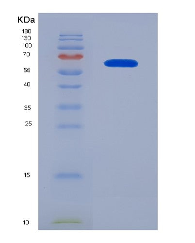 SDS-PAGE analysis of Human BSG (Basigin) - Recombinant Protein, CATHuman BSG (Basigin) - Recombinant Protein