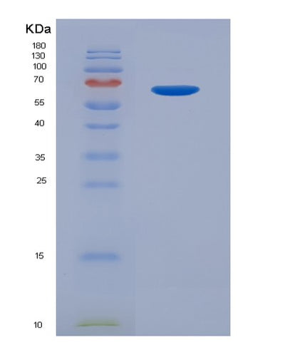 SDS-PAGE analysis of Human MPL (Thrombopoietin Receptor) - Recombinant Protein, CAT# BLT-07859P, showing >90% purity under 15% SDS-PAGE (Reduced)Human MPL (Thrombopoietin Receptor) - Recombinant Protein