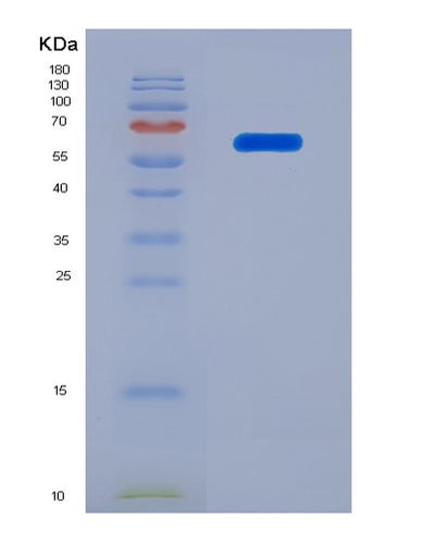 SDS-PAGE analysis of Human IGFBP2 (Insulin-Like Growth Factor-Binding Protein 2) - Recombinant Protein, CAT# BLT-07862P, showing >90% purity under 15% SDS-PAGE (Reduced)Human IGFBP2 (Insulin-Like Growth Factor-Binding Protein 2) - Recombinant Protein