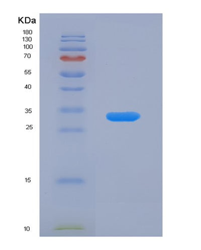 SDS-PAGE analysis of Human ANGPTL4 (Angiopoietin-Related Protein 4) - Recombinant Protein, CAT# BLT-07863P, showing >90% purity under 15% SDS-PAGE (Reduced)Human ANGPTL4 (Angiopoietin-Related Protein 4) - Recombinant Protein