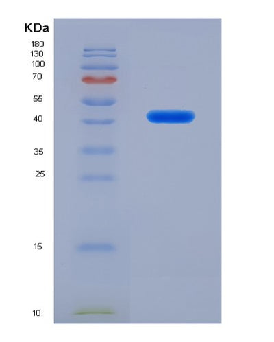 SDS-PAGE analysis of Human ANGPTL7 (Angiopoietin-Related Protein 7) - Recombinant Protein, CAT# BLT-07864P, showing >90% purity under 15% SDS-PAGE (Reduced)Human ANGPTL7 (Angiopoietin-Related Protein 7) - Recombinant Protein