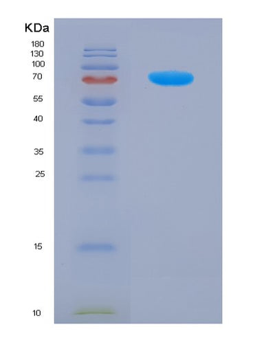 SDS-PAGE analysis of Human CD46 (Membrane Cofactor Protein) - Recombinant Protein, CAT# BLT-03540P, showing >85% purity under 15% SDS-PAGE (Reduced)Human CD46 (Membrane Cofactor Protein) - Recombinant Protein