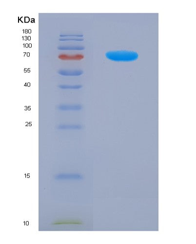 SDS-PAGE analysis of Human CD46 (Membrane Cofactor Protein) - Recombinant Protein, CATHuman CD46 (Membrane Cofactor Protein) - Recombinant Protein