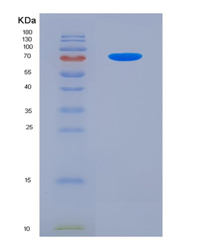 SDS-PAGE analysis of Human CD72 (B-Cell Differentiation Antigen Cd72) - Recombinant Protein, CAT# BLT-07865P, showing >90% purity under 15% SDS-PAGE (Reduced)Human CD72 (B-Cell Differentiation Antigen Cd72) - Recombinant Protein
