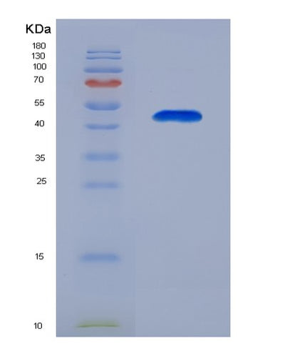 SDS-PAGE analysis of Human MUC1 (Mucin-1) - Recombinant Protein, CAT# BLT-07866P, showing >90% purity under 15% SDS-PAGE (Reduced)Human MUC1 (Mucin-1) - Recombinant Protein