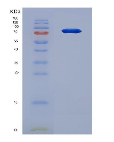 SDS-PAGE analysis of Human CSF3R (Granulocyte Colony-Stimulating Factor Receptor) - Recombinant Protein, CAT# BLT-05816P, showing >90% purity under 15% SDS-PAGE (Reduced)Human CSF3R (Granulocyte Colony-Stimulating Factor Receptor) - Recombinant Protein