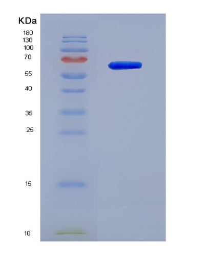 SDS-PAGE analysis of Human IFNAR2 (Interferon Alpha/Beta Receptor 2) - Recombinant Protein, CAT# BLT-04129P, showing >85% purity under 15% SDS-PAGE (Reduced)Human IFNAR2 (Interferon Alpha/Beta Receptor 2) - Recombinant Protein
