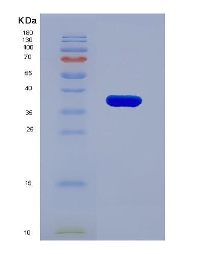 SDS-PAGE analysis of Human DSG2 (Desmoglein-2) - Recombinant Protein, CAT# BLT-07870P, showing >90% purity under 15% SDS-PAGE (Reduced)Human DSG2 (Desmoglein-2) - Recombinant Protein