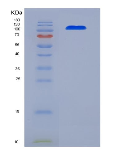 SDS-PAGE analysis of Human ALCAM (Cd166 Antigen) - Recombinant Protein, CAT# BLT-06845P, showing >95% purity under 15% SDS-PAGE (Reduced)Human ALCAM (Cd166 Antigen) - Recombinant Protein