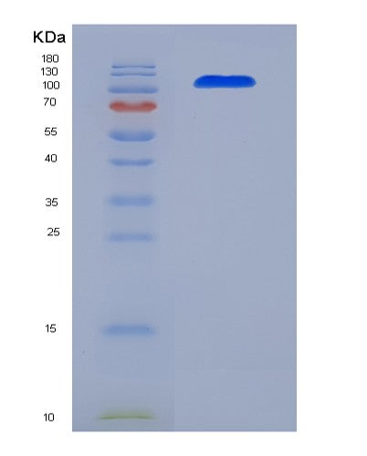 SDS-PAGE analysis of Human ALCAM (Cd166 Antigen) - Recombinant Protein, CATHuman ALCAM (Cd166 Antigen) - Recombinant Protein