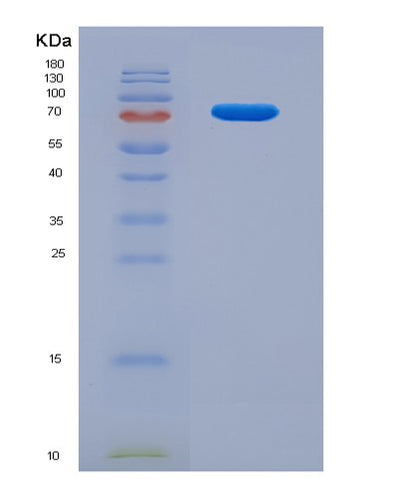 SDS-PAGE analysis of Human IL10RB (Interleukin-10 Receptor Subunit Beta) - Recombinant Protein, CAT# BLT-03498P, showing >85% purity under 15% SDS-PAGE (Reduced)Human IL10RB (Interleukin-10 Receptor Subunit Beta) - Recombinant Protein