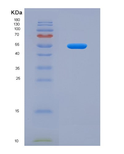 SDS-PAGE analysis of Human CSF2RB (Cytokine Receptor Common Subunit Beta) - Recombinant Protein, CATHuman CSF2RB (Cytokine Receptor Common Subunit Beta) - Recombinant Protein