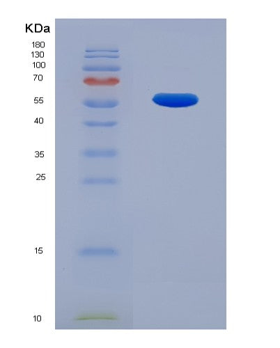 SDS-PAGE analysis of Human TNFRSF10D (Tumor Necrosis Factor Receptor Superfamily Member 10D) - Recombinant Protein, CATHuman TNFRSF10D (Tumor Necrosis Factor Receptor Superfamily Member 10D) - Recombinant Protein