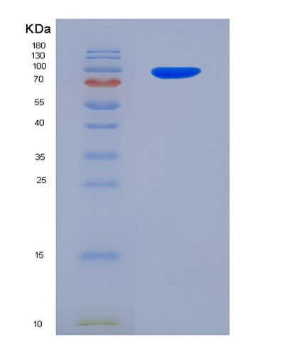 SDS-PAGE analysis of Human POSTN (Periostin) - Recombinant Protein, CAT# BLT-03867P, showing >95% purity under 15% SDS-PAGE (Reduced)Human POSTN (Periostin) - Recombinant Protein