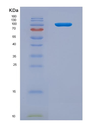 SDS-PAGE analysis of Human IL12RB2 (Interleukin-12 Receptor Subunit Beta-2) - Recombinant Protein, CAT# BLT-07875P, showing >90% purity under 15% SDS-PAGE (Reduced)Human IL12RB2 (Interleukin-12 Receptor Subunit Beta-2) - Recombinant Protein