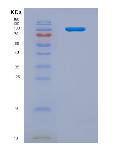 SDS-PAGE analysis of Human IL12RB2 (Interleukin-12 Receptor Subunit Beta-2) - Recombinant Protein, CATHuman IL12RB2 (Interleukin-12 Receptor Subunit Beta-2) - Recombinant Protein