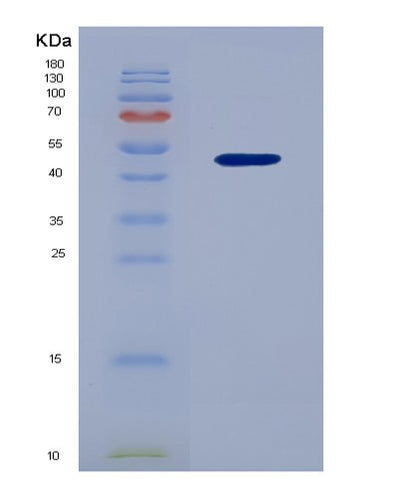 SDS-PAGE analysis of Human GFRAL (Gdnf Family Receptor Alpha-Like) - Recombinant Protein, CAT# BLT-07876P, showing >90% purity under 15% SDS-PAGE (Reduced)Human GFRAL (Gdnf Family Receptor Alpha-Like) - Recombinant Protein