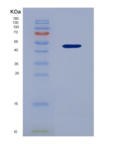 SDS-PAGE analysis of Human GFRAL (Gdnf Family Receptor Alpha-Like) - Recombinant Protein, CATHuman GFRAL (Gdnf Family Receptor Alpha-Like) - Recombinant Protein