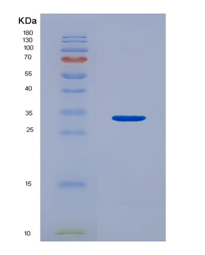 SDS-PAGE analysis of Human BTN1A1 (Butyrophilin Subfamily 1 Member A1) - Recombinant Protein, CAT# BLT-04270P, showing >95% purity under 15% SDS-PAGE (Reduced)Human BTN1A1 (Butyrophilin Subfamily 1 Member A1) - Recombinant Protein