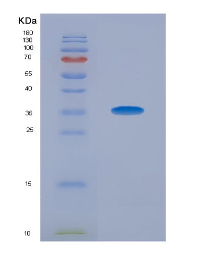 SDS-PAGE analysis of Human PDE4B (3',5'-Cyclic-Amp Phosphodiesterase 4B) - Recombinant Protein, CAT# BLT-07877P, showing >90% purity under 15% SDS-PAGE (Reduced)Human PDE4B (3',5'-Cyclic-Amp Phosphodiesterase 4B) - Recombinant Protein