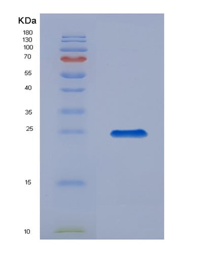 SDS-PAGE analysis of Mouse Tslp (Thymic Stromal Lymphopoietin) - Recombinant Protein, CAT# BLT-04419P, showing >85% purity under 15% SDS-PAGE (Reduced)Mouse Tslp (Thymic Stromal Lymphopoietin) - Recombinant Protein