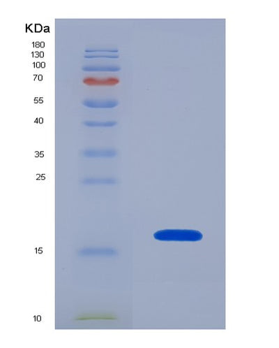 SDS-PAGE analysis of Human PDGFD (Platelet-Derived Growth Factor D) - Recombinant Protein, CAT# BLT-07878P, showing >90% purity under 15% SDS-PAGE (Reduced)Human PDGFD (Platelet-Derived Growth Factor D) - Recombinant Protein