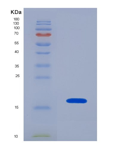 SDS-PAGE analysis of Human PDGFD (Platelet-Derived Growth Factor D) - Recombinant Protein, CATHuman PDGFD (Platelet-Derived Growth Factor D) - Recombinant Protein