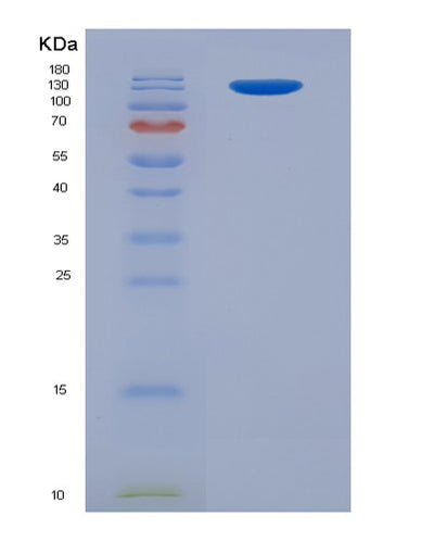 SDS-PAGE analysis of Human IGF2R (Cation-Independent Mannose-6-Phosphate Receptor) - Recombinant Protein, CAT# BLT-07879P, showing >90% purity under 15% SDS-PAGE (Reduced)Human IGF2R (Cation-Independent Mannose-6-Phosphate Receptor) - Recombinant Protein