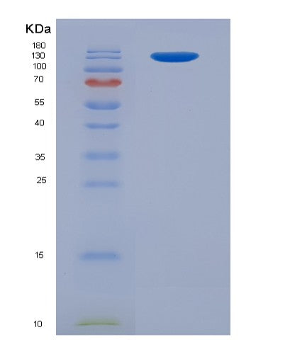 SDS-PAGE analysis of Human IGF2R (Cation-Independent Mannose-6-Phosphate Receptor) - Recombinant Protein, CATHuman IGF2R (Cation-Independent Mannose-6-Phosphate Receptor) - Recombinant Protein