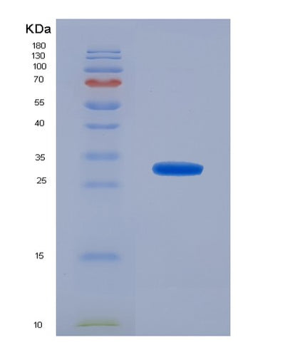 SDS-PAGE analysis of Human FCGR2A (Low Affinity Immunoglobulin Gamma Fc Region Receptor Ii-A) - Recombinant Protein, CAT# BLT-04401P, showing >95% purity under 15% SDS-PAGE (Reduced)Human FCGR2A (Low Affinity Immunoglobulin Gamma Fc Region Receptor Ii-A) - Recombinant Protein