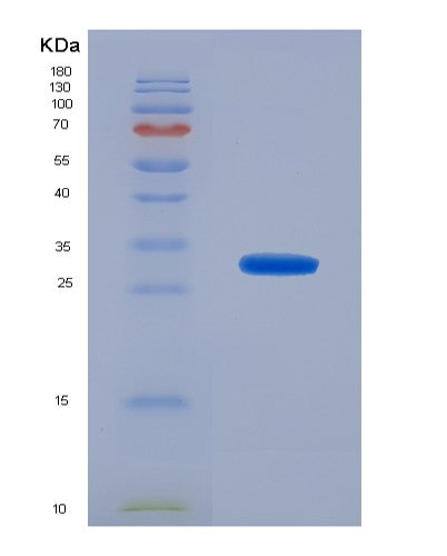SDS-PAGE analysis of Human FCGR2A (Low Affinity Immunoglobulin Gamma Fc Region Receptor Ii-A) - Recombinant Protein, CATHuman FCGR2A (Low Affinity Immunoglobulin Gamma Fc Region Receptor Ii-A) - Recombinant Protein