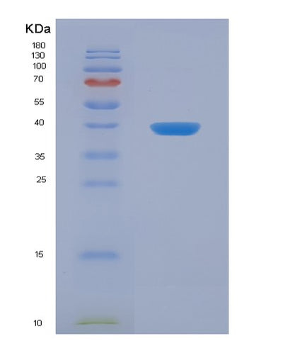 SDS-PAGE analysis of Mouse Cd274 (Programmed Cell Death 1 Ligand 1) - Recombinant Protein, CAT# BLT-06656P, showing >90% purity under 15% SDS-PAGE (Reduced)Mouse Cd274 (Programmed Cell Death 1 Ligand 1) - Recombinant Protein